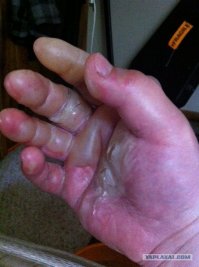 Держись от "зонтика" подальше