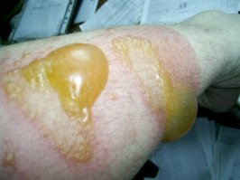 Держись от "зонтика" подальше