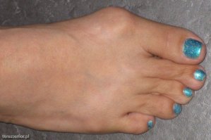 будущее всех любительниц туфелек годам к 30. но переживать не стоит - это поправимо