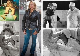 В 1983 году, трёхлетней литовской девочке Расе, какой-то сельхозмашиной отрезало обе ножки на уровне нижней трети голеней.
Для Ту-134, по тревоге поднятому той ночью в Литве, «расчистили» воздушный коридор до самой Москвы. Диспетчеры знали — в пустом салоне летит маленький пассажир. Ножки, обложенные мороженой рыбой, летят на соседнем сиденье.
Менее, чем через 12 часов маленькая дочь литовского тракториста из колхоза «Вадактай» уже лежала на операционном столе в Москве.
Оперировали девочку врачи — хирурги сосудистой бригады, созданной на базе 51 больницы Москвы.
Возглавляли бригаду Степанов и Акчурин, а остальные были на равных: Ширяев, Датиашвили, Миланов, Бранд и многие другие.
Они были первыми в СССР сосудистыми хирургами, которые работали в единой бригаде, созданной на базе Всесоюзного Научного Центра Хирургии и 51 городской больницы всего за 2 года до этих событий.
Эта была очередная, пусть сложная, но именно очередная операция. До нее были сотни пришитых пальцев, а после нее были ещё тысячи операций на сосудах и на сердце..
Не было в операционной ни профессоров, ни академиков. Были два молодых, но очень талантливых хирурга, которым просто выпало дежурить в этот день. Оперирующему хирургу Рамазу Датиашвили было всего 28 лет, столько же- ассистирующему ему доктору Якову Бранду.
Операция прошла удачно.
Потом были годы реабилитации.
Родители девочки — очень пьющие, деградирующие люди.
Но девочку ещё не один раз оперировали в Москве, «выравнивали». ноги с помощью аппаратов Илизарова. Несколько лет Раса практически жила в больницах Москвы.
Потом для Расы нашли приёмную семью.
В конце концов, ноги у неё стали не хуже, чем у других людей.
Известно, что в 2014 году Раса жила в Германии. Вышла там замуж за «земляка»- немца из Казахстана Ефима Септа.

Сегодня в этой истории поражает то, что всё это: ночной самолёт для единственного пассажира, полёт в Москву, ночная операция, лечение, реабилитация,были совершенно бесплатными. И для кого? Для дочери деградирующих алкоголиков.
И всё это быстро, чётко, организованно.
Оперировали её тоже бесплатно молодые хирурги, работающие не ради своих 120 рублей в месяц, а ради интереса к своей профессии, ради кайфа сложных операций и новых возможностей.
И ведь не нужно было собирать деньги, как собирают их сейчас в интернете!
Не подключались никакие шумные фонды и Астахов. Не искали спонсоров. Не звали иностранных специалистов.
Огромный неповоротливый, казалось бы, Союз, ради заморыша со своей окраины — встряхнулся и сделал невозможное.
Клянусь, друзья мои, случись такое сейчас , и не где нибудь в глубинке, а в солидном областном центре, всё имело бы совсем иной сюжет!
Уверен, нашли бы сотню причин и противопоказаний, чтобы не оперировать. Не отрывать зад от кресла, не вылазить из- под одеяла, не рисковать.
А к чему? На ублюдке этом - ничего не заработаешь.
Отрезанные ноги сожгли бы в кочегарке. Сформировали бы кое- как культи ног и обрекли бы девочку на российские протезы- тяжёлые, не функциональные, раздирающие кожу культей в кровь.
Много плохого было в СССР, но и много хорошего мы потеряли с его исчезновением.