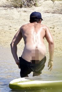 Чё за шрам на спине? операция на позвоночнике?