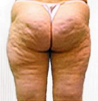 Ямочкииииии!