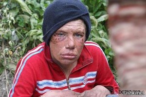 Когда у меня БОМЖ просит помощи (естественно деньгами)я помогаю бесплатным советом- иди воруй, а если боишься то работай. А тому парню что описан в посте купил бы и абонемент годовой в тот же зал.