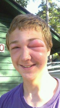 Пчёлы среднерусской породы - печатка сухая.
Забор глухой. Надеюсь соседей нет рядом. 
Иначе среднерусские пчёлы держат соседей в тонусе. 
Особенно в период забирания магазинов.