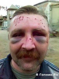 Надо было с подставщиком провести воспитательную работу.
Желаемый результат - на фото. ;)