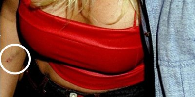 ... судя по синякам Эминем подружку лупил почем зря :)