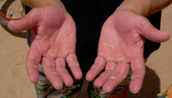 Группе потдежки и болельщикам тоже достается. Сурово всё.