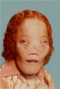 Фото Рокки Денниса.