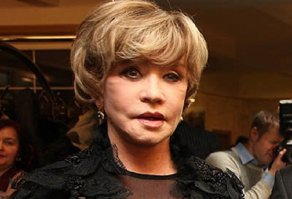 В 2014 Алентову вот так украсили пластические коновалы