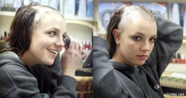 12 удивительных фотографий "до и после", которые вас поразят