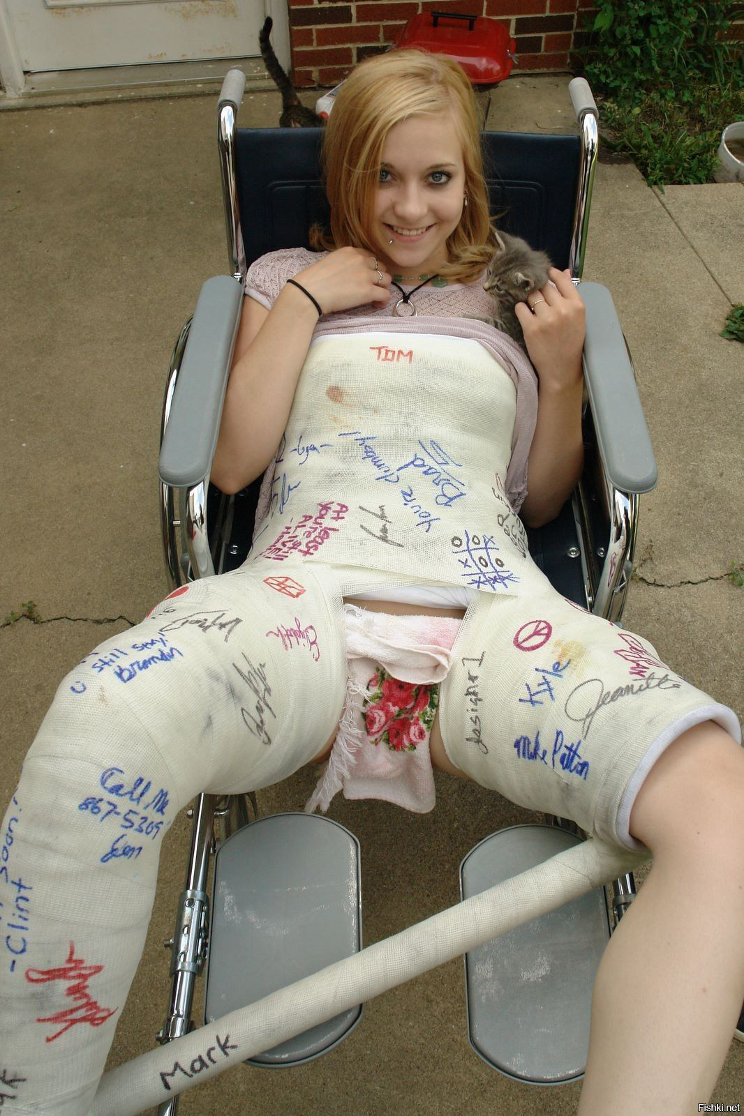 Leg cast vk