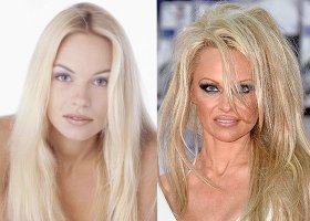 Нехрен увлекаться разными продлениями товарного вида морды лица и будет к старости неплохо выглядеть!