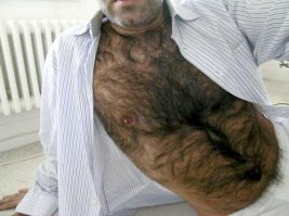 Что за дискриминация?