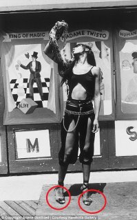 Проблема слишком узкой обуви