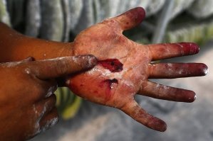 Если таким образом раздавить одного из людей, картина будет очень похожей))