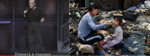 В Бангладеш родился малыш, который выглядит как старик