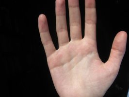 Эмм... А у меня например также как на этом фото. И где мой прогноз?