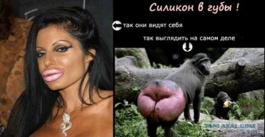Мать позволила дочери увеличить губы ради зависти одноклассниц