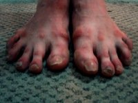 для тех, кто против носок в сандалиях.
Представьте себя в компании таких ног: