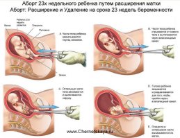 Надо, надо поднимать такие темы.