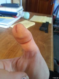 Один раз утром готовила себе бутерброд, ну и рубанула палец вот таким же образом, только до кости. Аж ноготь разрубила, ибо длинные были ногти. Боже, как же он болел, и такое ощущение, что руки нет, без участия большого пальца на правой руке фиг что сделаешь...