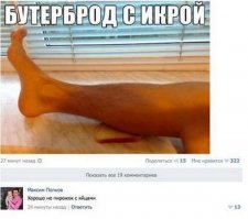 Поступает как-то мужчина на гастроэнтерологию, проверить функцию желчевыводящих путей. А таких больных кладут на отделение накануне, и, чтобы диету-назначения соблюдали, медсестра выдает им распечатанную на принтере инструкцию. А в самом конце инструкции написано: …утром на обследование взять с собой полотенце, 2 сырых яйца (желчегонный завтрак). Вот только в этот раз, вынимая лист из принтера, нечаянно оторвали уголок бумаги. И получилось:...утром на обследование взять с собой полотенце, 2 сырых…

Пациент встает утром и идет в ванную мочить вафельные полотенца. "Ты чего?" - спрашивает его сосед по палате. Так написали. И идет в ординаторскую. Там сидит дежурный врач, пожилая женщина, пишет историю болезни.

- Я такой-то такой-то, - объявляет пациент.

- Хорошо, подождите минутку, - продолжает писать доктор. И, не поднимая головы: - Яйца с собой?

- С собой - подофигел дядечка.

- Кладите их сюда…

- Куда???

- Сюда, на стол, на полотенце, - не поднимая глаз, автоматически машет рукой перед собой.

Пациент, тихо фигея, аккуратно расстилает мокрые полотенца, спускает штаны и кладет яйца сверху. Все как просили. Доктор дописывает строчку и поднимает, наконец, голову. На ее вопли (а чего орать, никогда не видела что-ли? сомневаюсь) сбежалось все отделение. Мужика отпаивали дарственным коньяком. Он еще полчаса где-то не мог ничего сказать, кроме: "У-у-уу! Ссссука!"