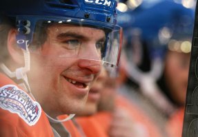 Женщине удалили 20 зубов, чтобы избавить её от чудовищно кривых зубов