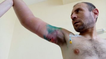 Никого не хочу обвинять. В жизни бывает самое разное. Вот только что удивляет: если принять во внимание, что возникновение гематом на руках происходило практически день-в-день с проведением ЛОР-операции, то почему на лице пострадавшего отсутствуют следы операции по исправлению носовой перегородки?! Это вам не прыщ выдавить - лицо существенно опухает + почти всегда мощные кровоподтеки под глазами. Они физически не могут рассосаться намного быстрее, чем следы от ремней на руках.