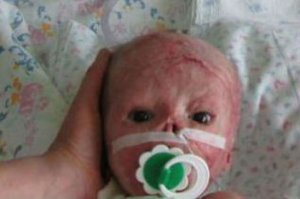 Отрадно осознавать,что медицина все же не стоит на месте. Давайте будем надеяться, что Матвейке тоже скоро помогут.