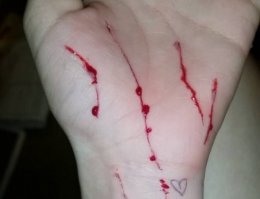 спиртом полей руку и промой водой, проблем то ппц, сразу к врачу надо, ещё скороую вызови))))