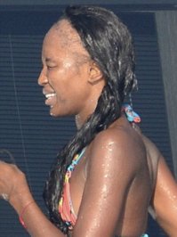 Наоми Кэмбел наверное тоже облысела из-за того же средства? ;) Или всё-таки виной тому постоянное ношение париков и экстремальное выпрямляние афроволос?