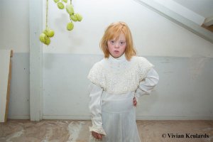 Жесть
У девочки диагноз прям написан на лице..