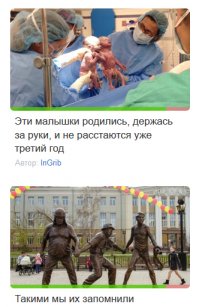 Эти малышки родились, держась за руки, и не расстаются уже третий год