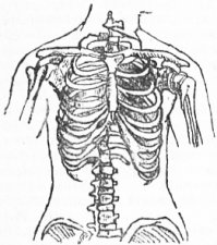 Нормальная женская грудная клетка.
 

Женская грудная клетка, изменённая после ношения корсета.