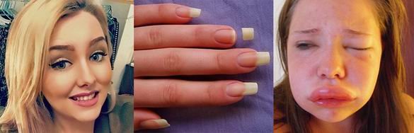 При переживаниях лицо и шея девушки увеличиваются вдвое