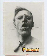 Цирк уродов: 15 фотографий, после которых могут присниться кошмары