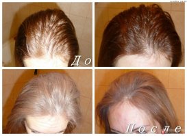 Косметический Тальк !!!
Это же САЛОН КРАСОТЫ.
На заднем плане Кресла ПарикмаХера !