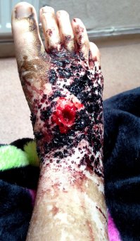 Аффтор, ты д.о.л.б.о.ё.б! Какой вросший ноготь? Фотографии неотфотошопленные слабо выложить было? Или в погоне за плюсиками все средства хороши?



Вот одна из фотографий, только БЕЗ ФОТОШОПА: