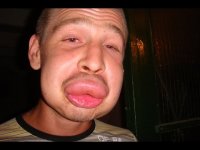 17 фотографий собак, которые съели пчелу