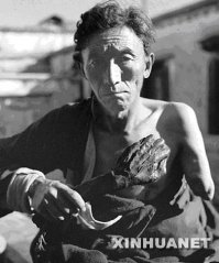 1959 год.В Тибете Национальная освободительная армия Китая отменяет рабство.

Раб, держащий свою отрубленную хозяином руку.