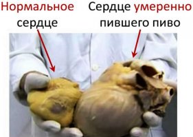 ИН или ИН