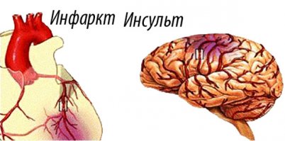 ИН или ИН