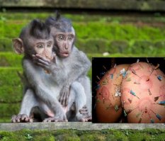 вот болезнь !