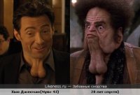 Непальцу удалили огромную опухоль на лице, с которой он прожил 47 лет