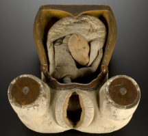 Если вы посмотрите внимательно, вы, вероятно, увидите больше, чем хотели. Присмотритесь и Вы увидите долговязого маленького ребенка, с желтой подушкой-плацентой внутри беловатой матки. И всё это лежит в небольшом, выдолбленном из дерева туловище. Акушерский тренажер использовался на протяжении веков для подготовки врачей и акушеров. Именно этот тренажер был сделан в Италии и ему больше трех веков. Он считался очень передовым в своё время.