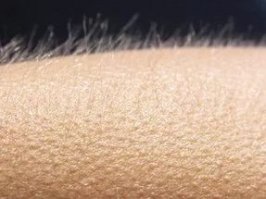 И вот так вот по всему телу.