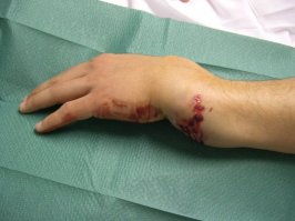 ХЕРРРАКККК