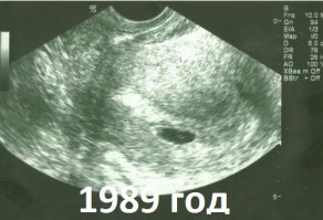 Эммочку, годы точно не пощадили