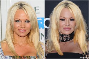 Угу, прямо другой человек просто. Пластику волос сделала.