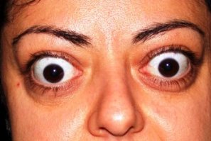 У Киркорова начинается базедова болезнь? Что-же он как дурак все время глаза таращит?